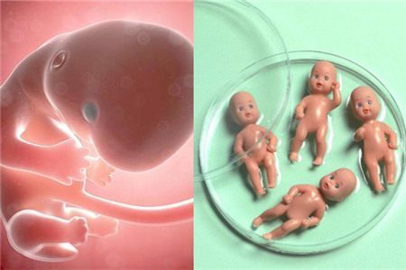 借卵代生包女孩代生包成功